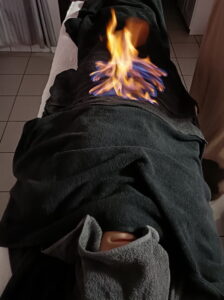 Masaż ogniem na drzuchu